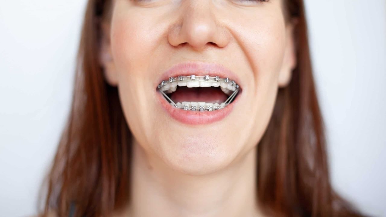 Ease Jaw Strain and Promote Bite Balance