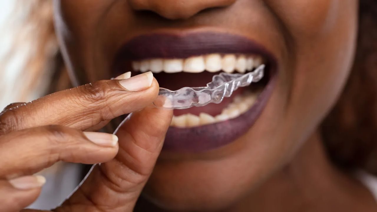 Protect Adjacent Teeth and Reduce Harmful Shifting